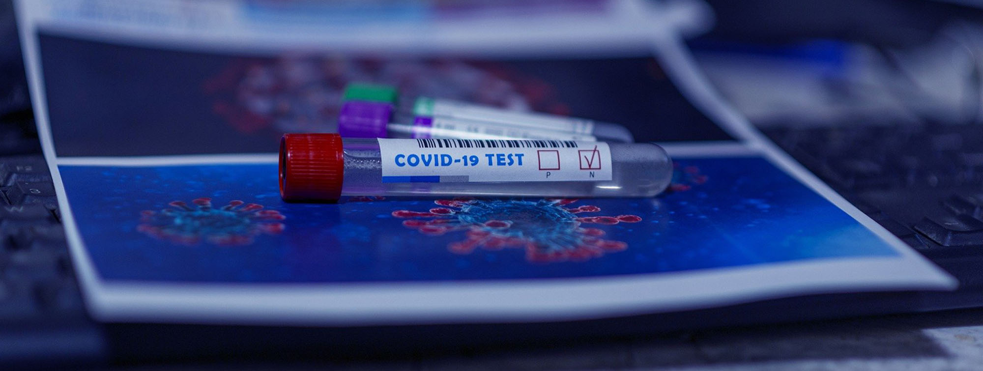 ¿Qué test de coronavirus me conviene más para Navidad? Diferencias entre PCR,  Antígenos y Anticuerpos.